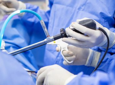 laparoskopi cerrahi